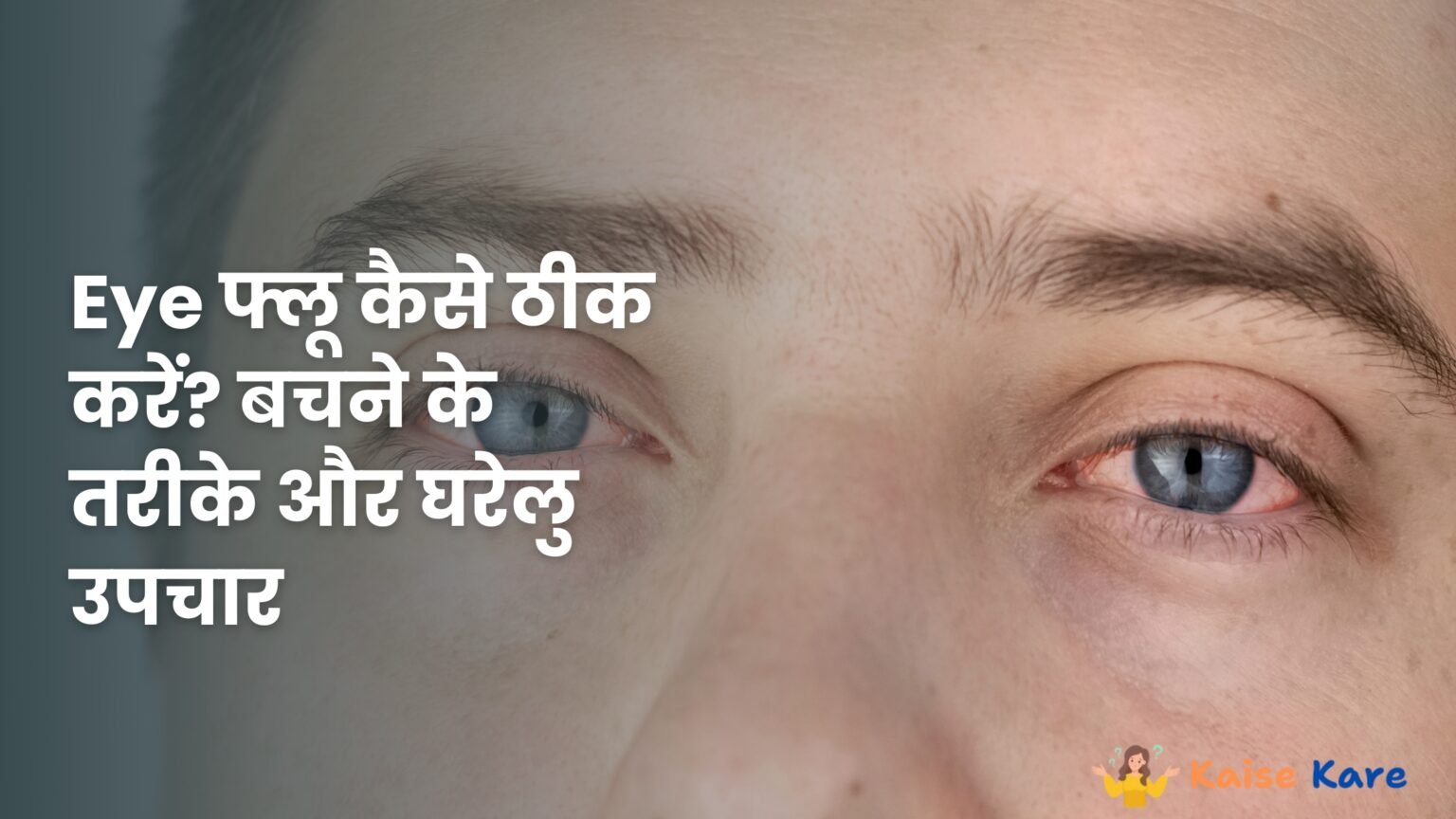 Eye फ्लू कैसे ठीक करें